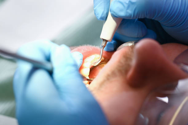 Best Cracked Tooth Emergency Dentist  in Morton, PA
