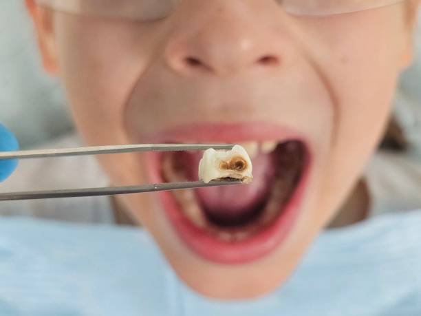 Best Knocked-Out Tooth Emergency  in Morton, PA